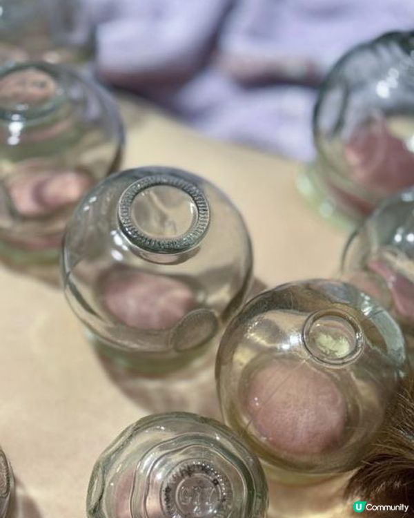 免診金優惠！愛上了養康中醫館人氣中藥藥膜同無痛拔火罐袪濕氣療程（詳細分享）！