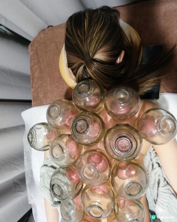 難怪養康中醫館人氣拔火罐袪濕氣療程成日大排長龍, 原來過程安全又舒服