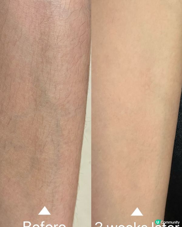 ❮𝗨𝗹𝗶𝗸𝗲藍寶石 𝗔𝗶𝗿 𝟯冰點家用美容儀❯