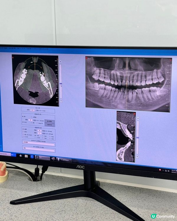 愛康健|北上洗牙全記錄🦷