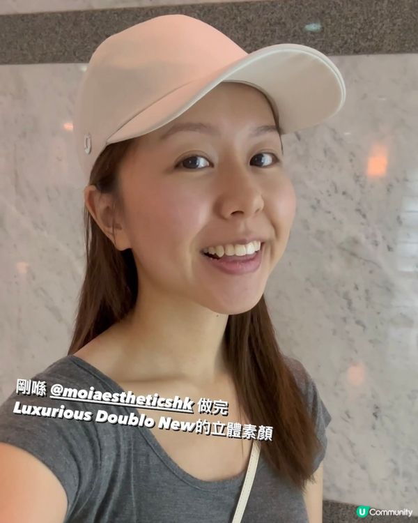 還原立體童顏肌✨✨ New Doublo SD微雕拉提