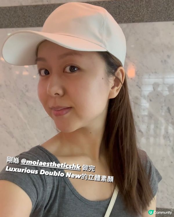 還原立體童顏肌✨✨ New Doublo SD微雕拉提