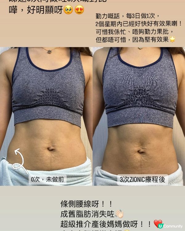 拯救產後鬆弛腰肚，快速瘦身 「ZIONIC 水母機」