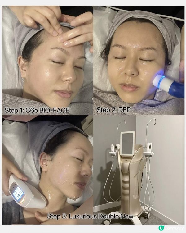 【醫美】moi aesthetics 體驗結合HIFU + RF "New Doublo SD微雕拉提"