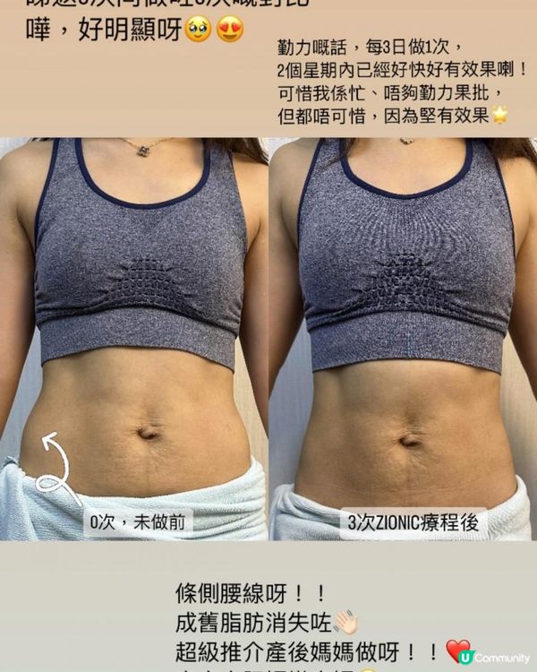 拯救產後鬆弛腰肚，快速瘦身 「ZIONIC 水母機」