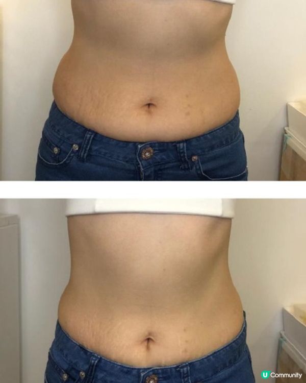 2024 唔hard sell美容院推薦!可選擇單次收費美容