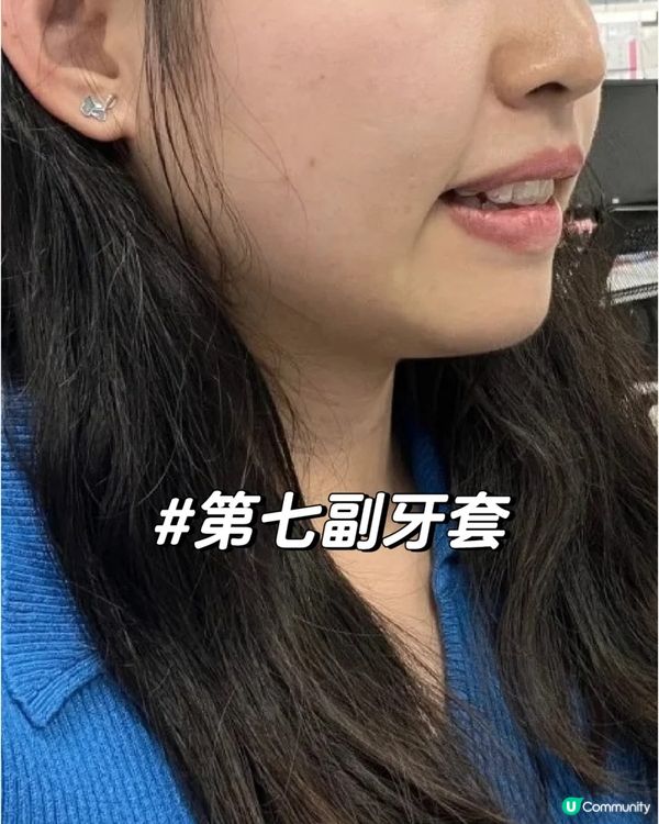 珠海正畸嘅個人感受同經歷