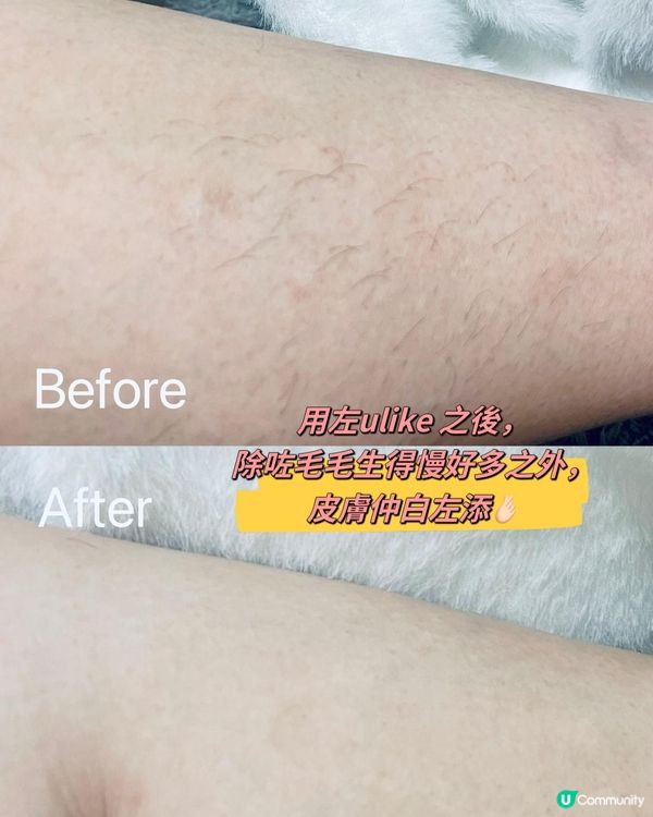 限時必買🈹️只要$2099就可以同全身毛毛講bye bye‼️