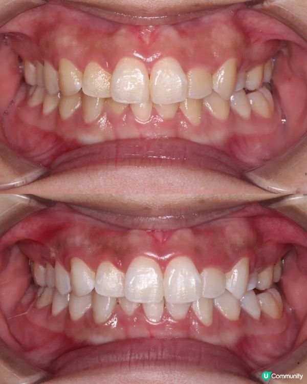 珠海度邊間醫院整牙齒美白好呀？