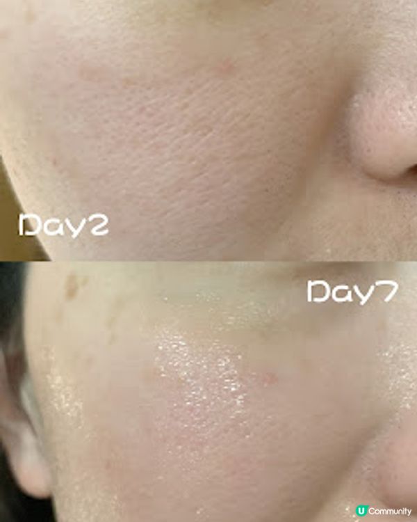 [不正妹愛美麗］*～Lancôme Génifique 小黑瓶。急救疲倦肌膚復活記～*