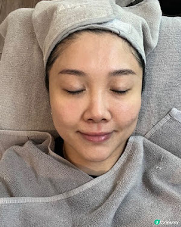 銅鑼灣單次收費美容院 @第2次做完美無瑕牛奶肌效果 #LSB