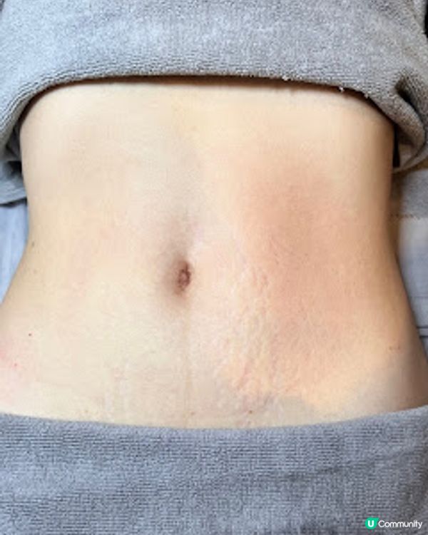 單次收費美容院做產後修復療程