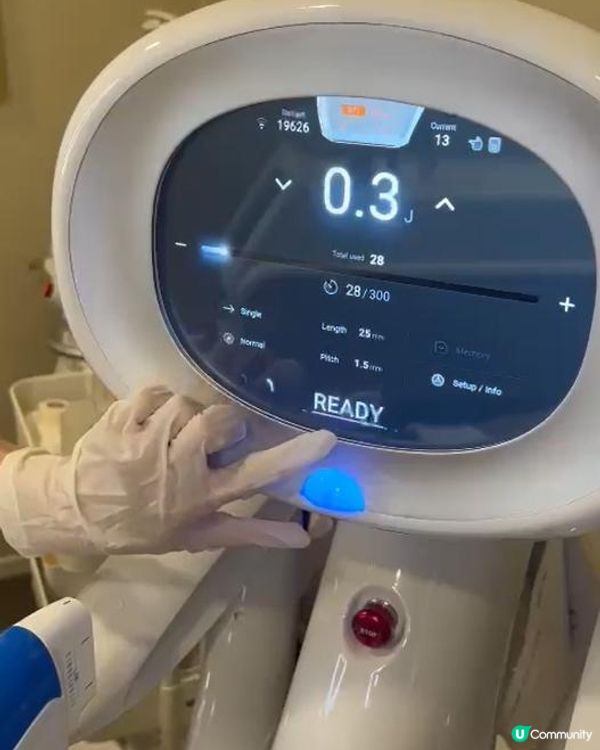 ⛓️鋼筋索HIFU 療程後感受 -🥰V面新挑戰 Ultraformer 第四代MPT