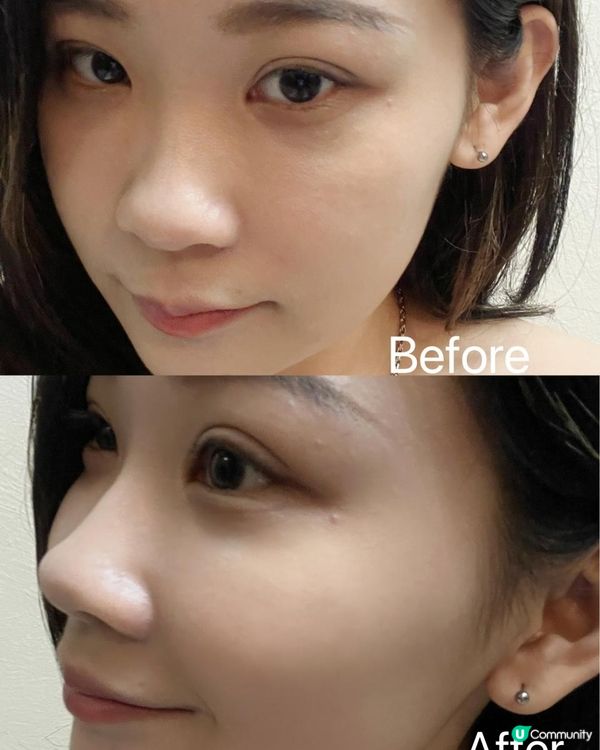 【新加坡醫學護膚品牌DERMA LAB 40秒舒敏保濕】