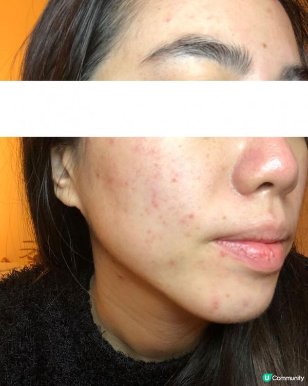 ｜美妝護膚｜ 內附大量爛面圖 + 復原過程｜遇見Miuns+ 魔鏡｜