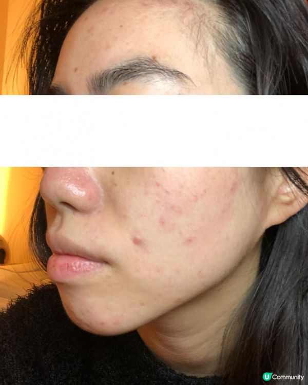 ｜美妝護膚｜ 內附大量爛面圖 + 復原過程｜遇見Miuns+ 魔鏡｜