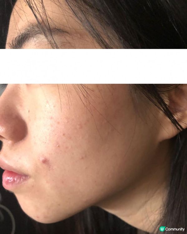 ｜美妝護膚｜ 內附大量爛面圖 + 復原過程｜遇見Miuns+ 魔鏡｜