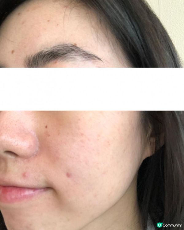 ｜美妝護膚｜ 內附大量爛面圖 + 復原過程｜遇見Miuns+ 魔鏡｜