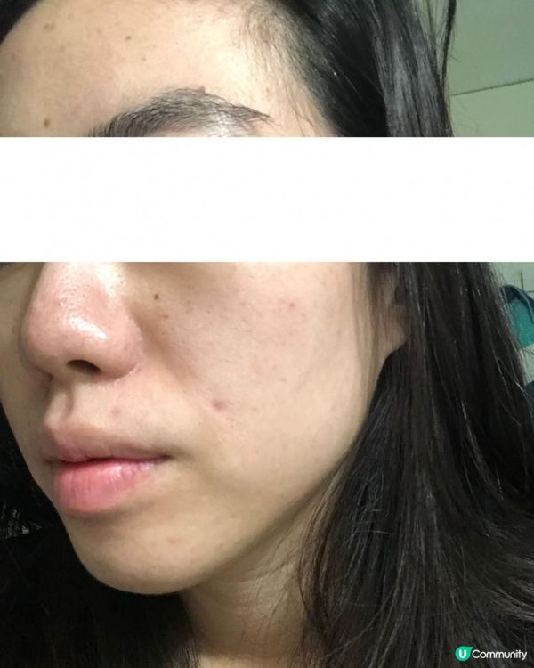 ｜美妝護膚｜ 內附大量爛面圖 + 復原過程｜遇見Miuns+ 魔鏡｜