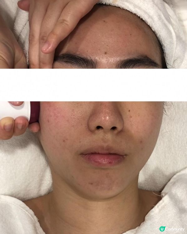 ｜美妝護膚｜ 內附大量爛面圖 + 復原過程｜遇見Miuns+ 魔鏡｜