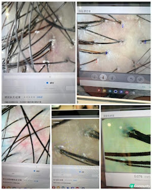 隱世明星診所－康熙年中醫 皇牌「太極頭療」從根本改善頭油、脫髮及失眠等問題