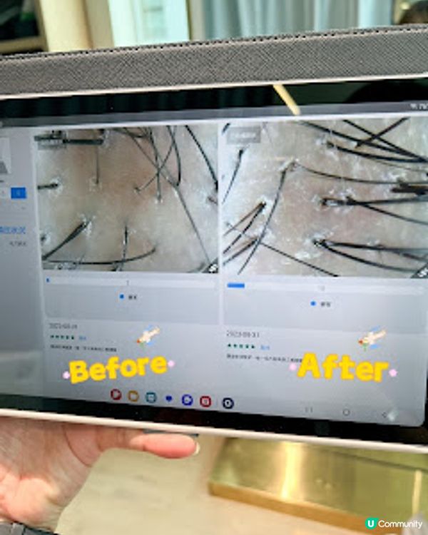 隱世明星診所－康熙年中醫 皇牌「太極頭療」從根本改善頭油、脫髮及失眠等問題