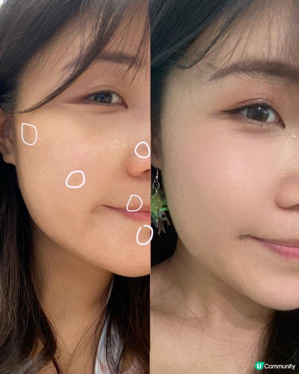 Caudalie全新產品 x Vinopure葡萄淨化急救暗瘡膏🍇