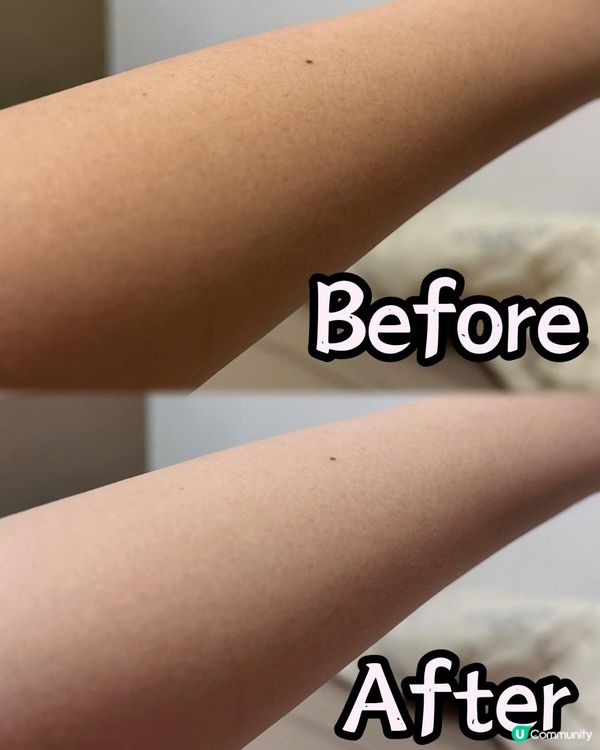 想皮膚白滑，要食WholeLoveMED醫美級冰肌蕃茄亮白丸