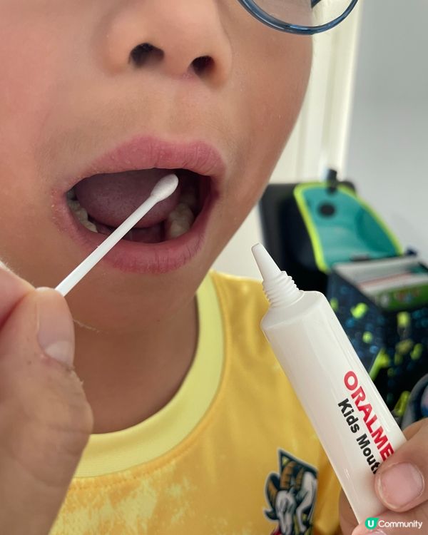 【家中必備 兒童口腔損傷萬用膏】