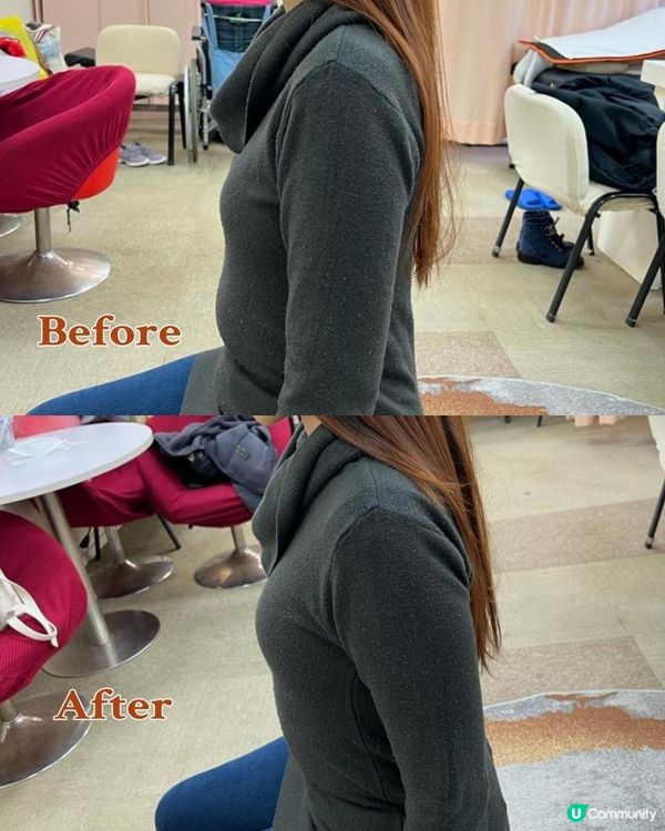 Dr. Yan健康骨骼及專業護脊中心 Dr. Yan收費 脊椎側彎、痛症治療的效果 吳錞銦 Dr Yan好唔好