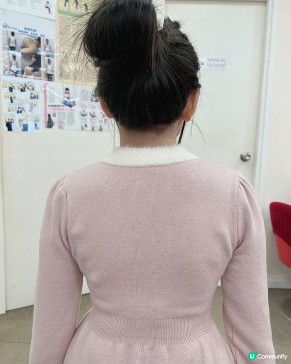 Dr. Yan健康骨骼及專業護脊中心 收費脊椎側彎治療的效果 Dr Yan好唔好 (吳錞銦)