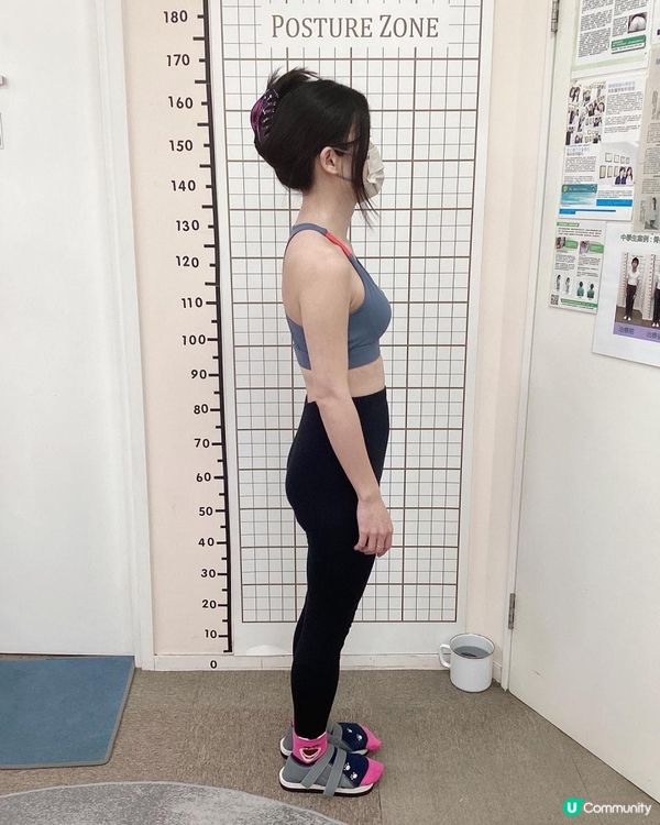 Dr Yan 健康骨骼好唔好 (吳錞銦), 收費vs效果, 脊椎側彎治療過程