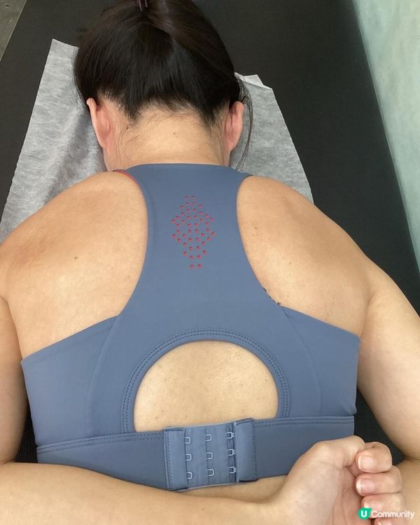 Dr Yan 健康骨骼好唔好 (吳錞銦), 收費vs效果, 脊椎側彎治療過程