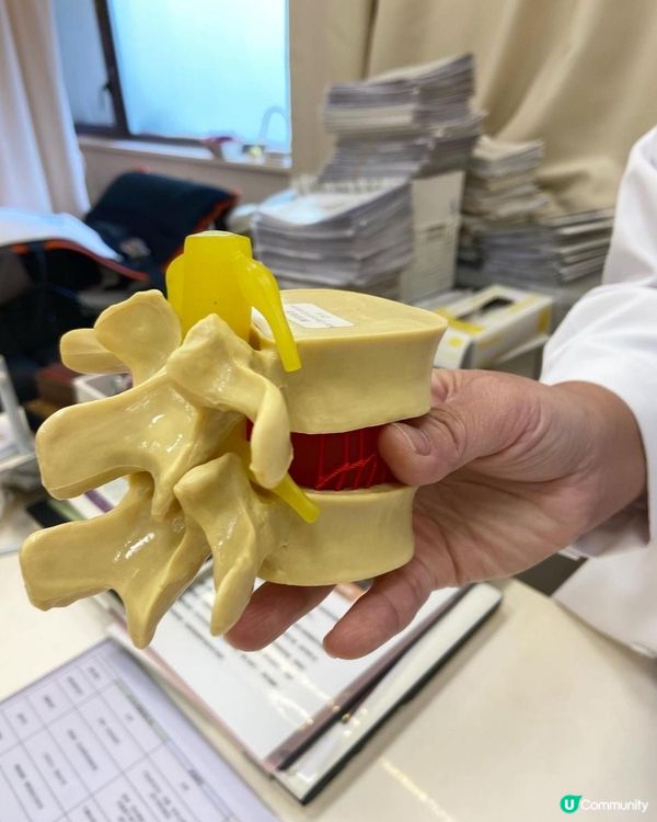 Dr Yan 健康骨骼好唔好 (吳錞銦), 收費vs效果, 脊椎側彎治療過程