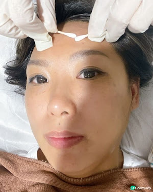 養康中醫館新出中藥藥膜超驚喜，原來暗瘡都可以敷中藥mask！