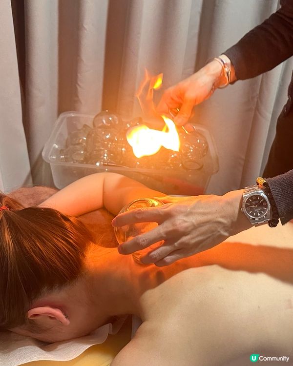 養生體驗🌟 養康中醫館人氣拔火罐袪濕氣療程