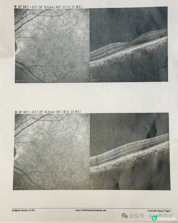 陪我妈妈去医院看眼科日记