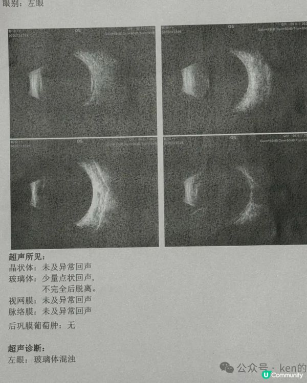 陪我妈妈去医院看眼科日记