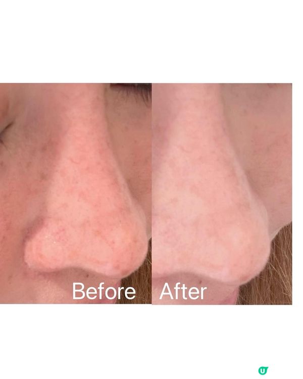 厚敷唔心痛‼️ INFYNYTI® 竹炭毛孔清潔透亮凍膜便宜大碗