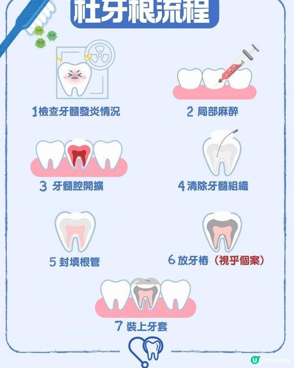 杜牙根會唔會好痛？了解根管治療7個步驟減輕心理壓力