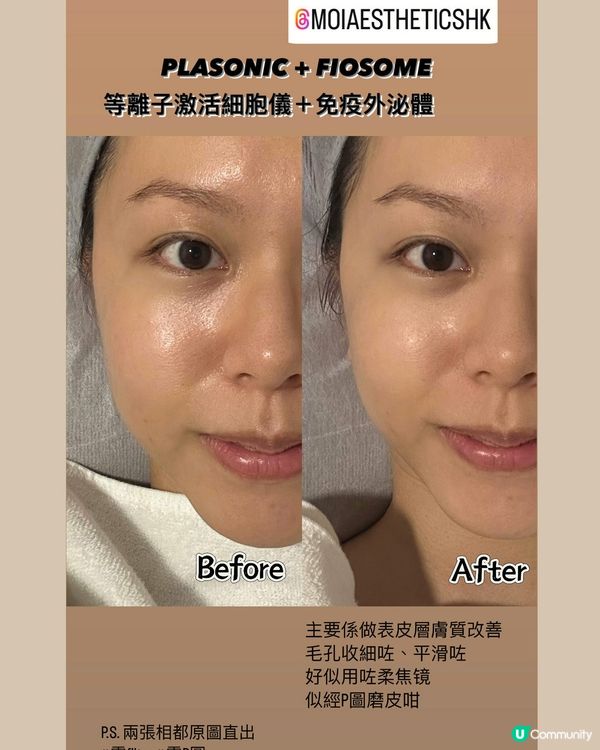 2024年美容界最HIT!! Exosome外泌體療程