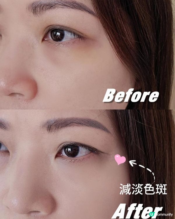 煥白美肌🤍Spa Treatment eX煥膚亮白系列🤍