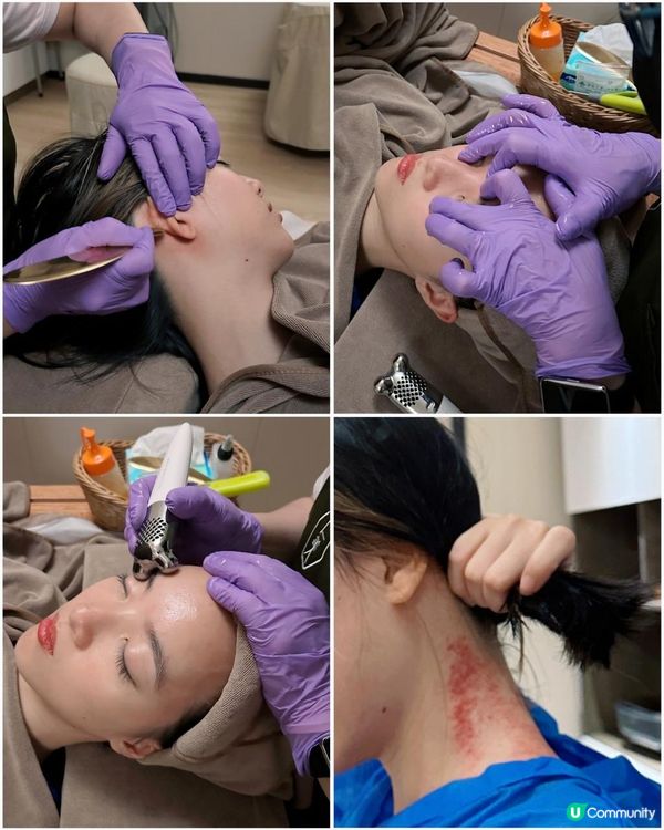 實測「仁美中醫養生診所」全港獨家『迴藥汗療』!!瞓住覺都可以補氣益血