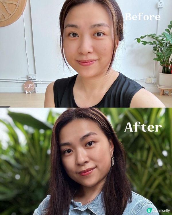 【CP值高 超有效去斑方法】+medispa $333, $999/3次enLIGHTen Pico激光去斑