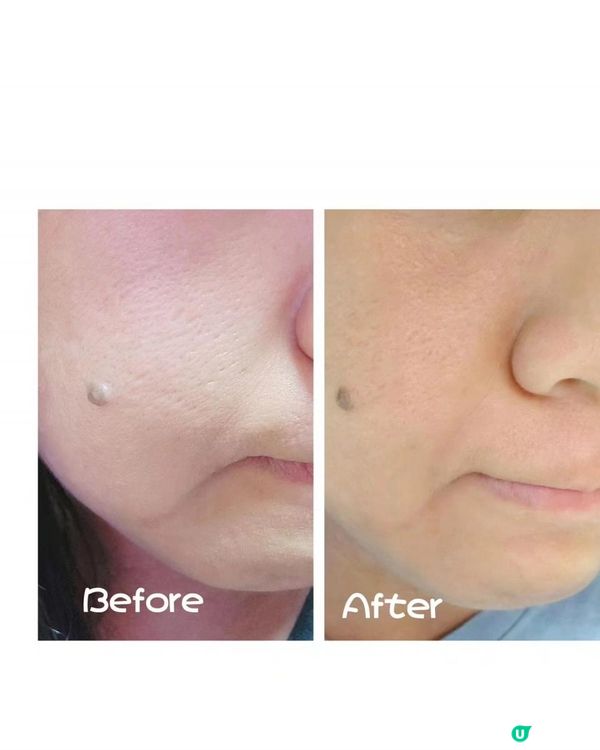 《鼠妹🐿的控油好物》