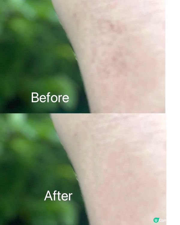 如果你都同我一樣有濕疹問題，真心值得－試👍🏻👍🏻