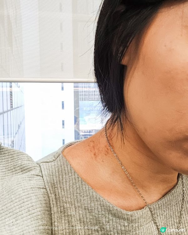 【中醫養生】仁美中醫養生診所迴藥汗療大爆汗!!