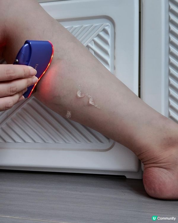 🧏🏻‍♀️ 去水腫的方法 《EMAY PLUS 外用祛濕搽+美容水刮即時刮走1cm¹》