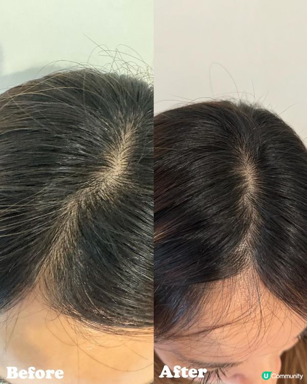 PHYTO植萃健康防脫育髮