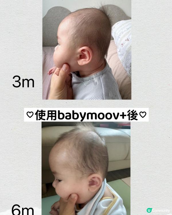 #預防嬰兒扁頭好物分享 👶🏻《babymoov Lovenest 枕頭》  #有圖分享前後對比